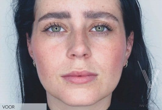 Deze foto's zijn van Ivy clinics Westervoort