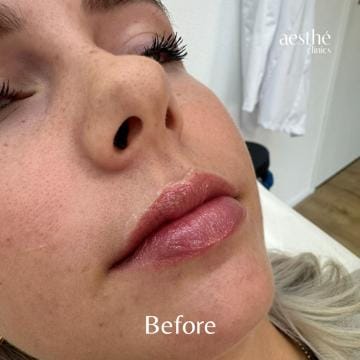 Deze foto's zijn van Aesthé Clinics Hengelo