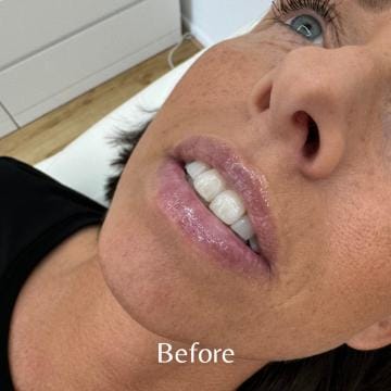 Deze foto's zijn van Aesthé Clinics Hengelo