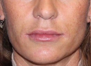 lippen-detail